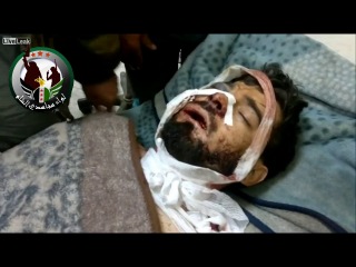 syria. the sniper shot half the face of the militant.